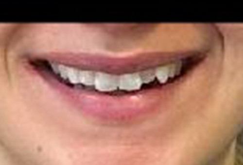 Before