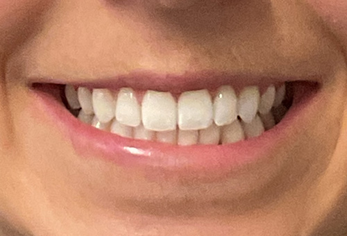 After