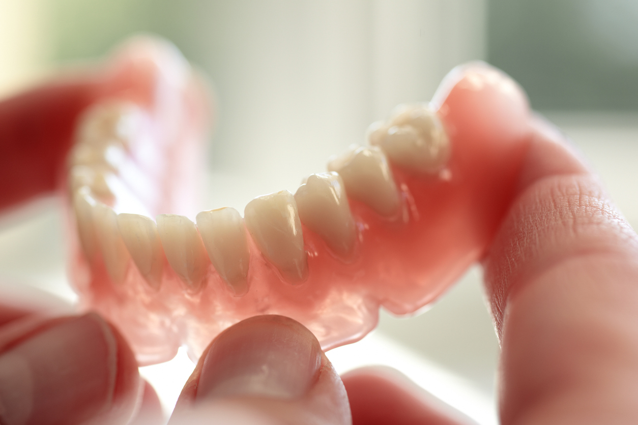 Removable denture that can become loose over time as the jawbone shrinks